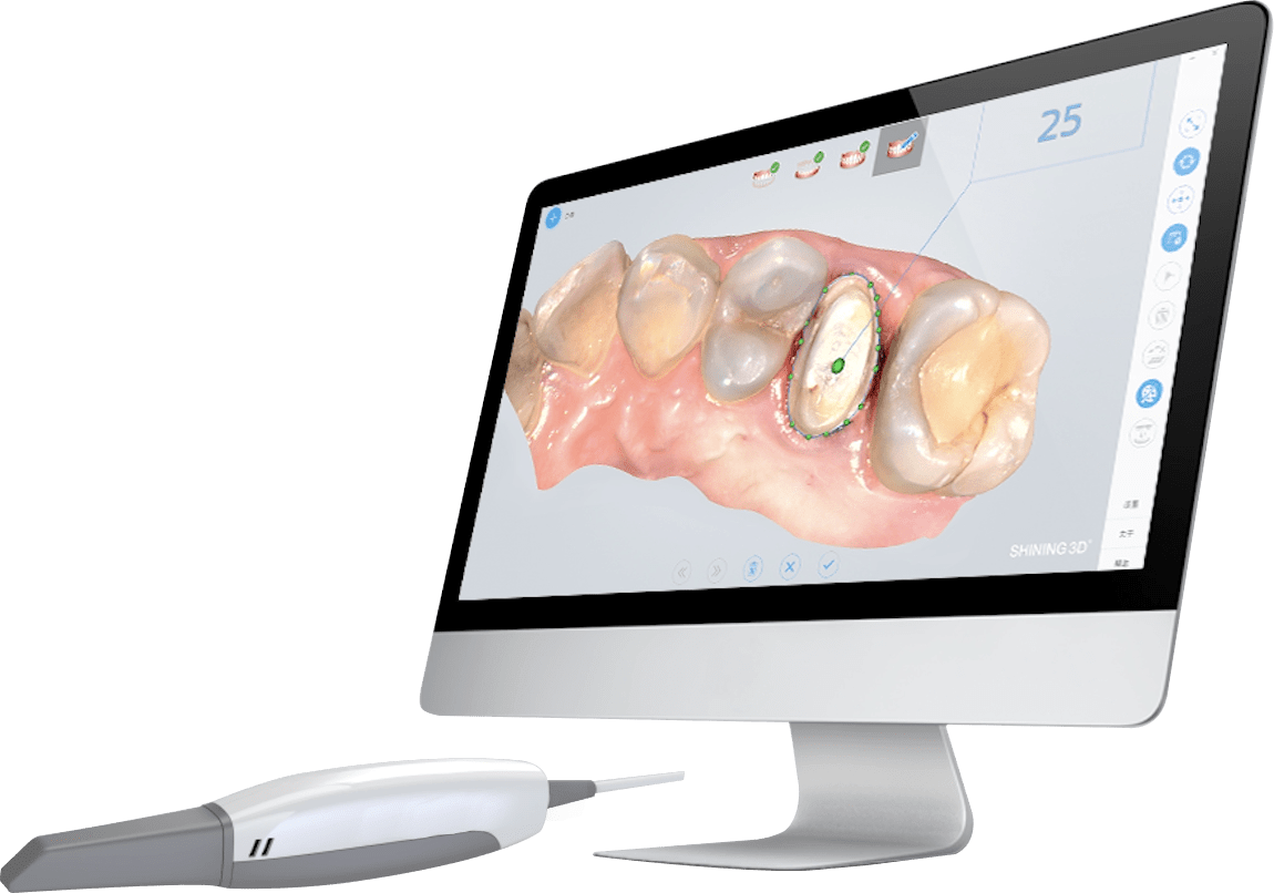 Scanners 3D