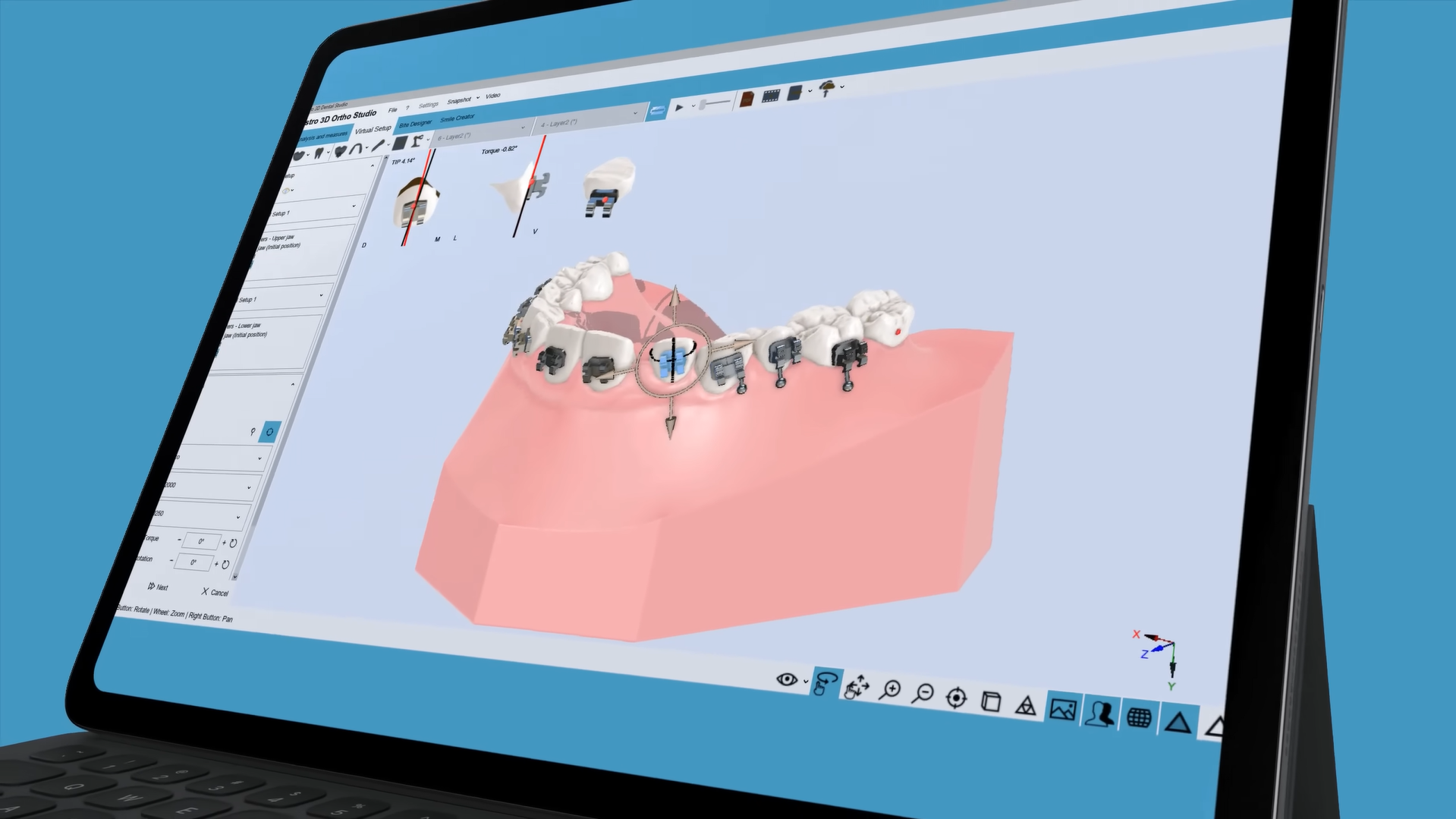 Chargement de la vidéo