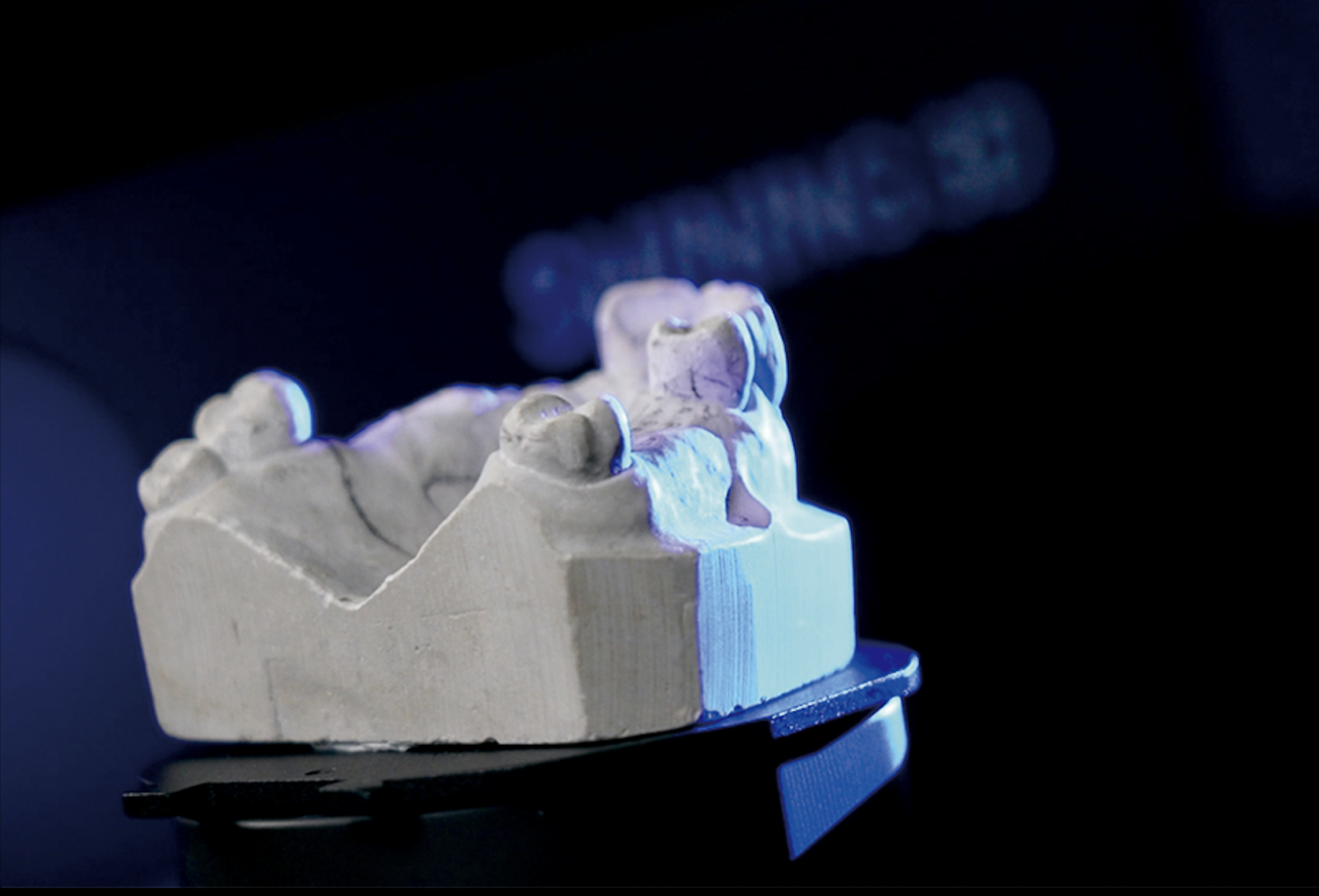 Scanner 3D Dentaire AutoScan DS-EX PRO H