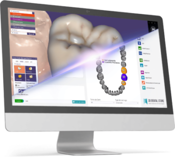 Licence Perpétuelle Flexible d'Exocad DentalCAD pour Prothésistes