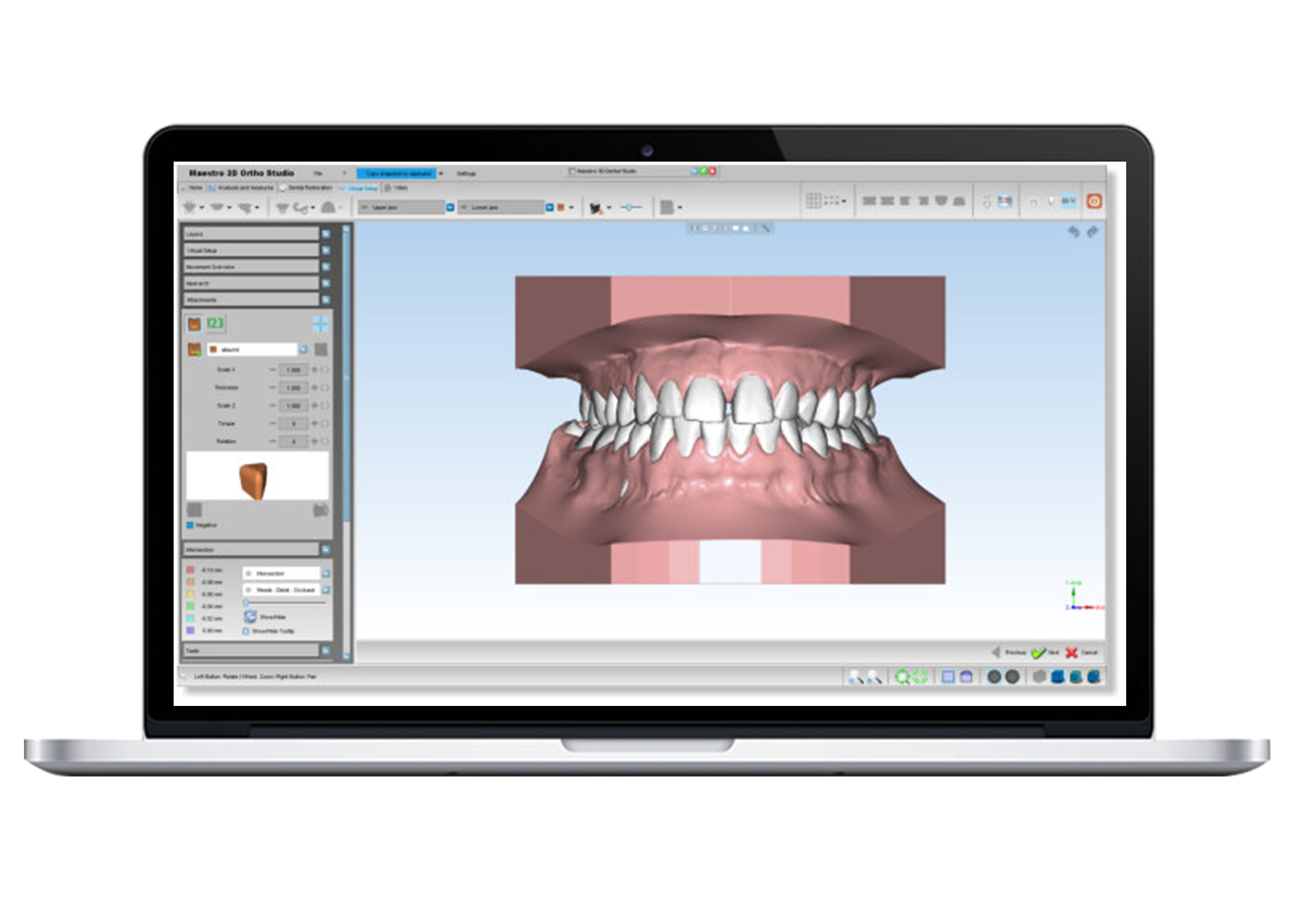 Logiciel d’Orthodontie Maestro 3D – Configuration A