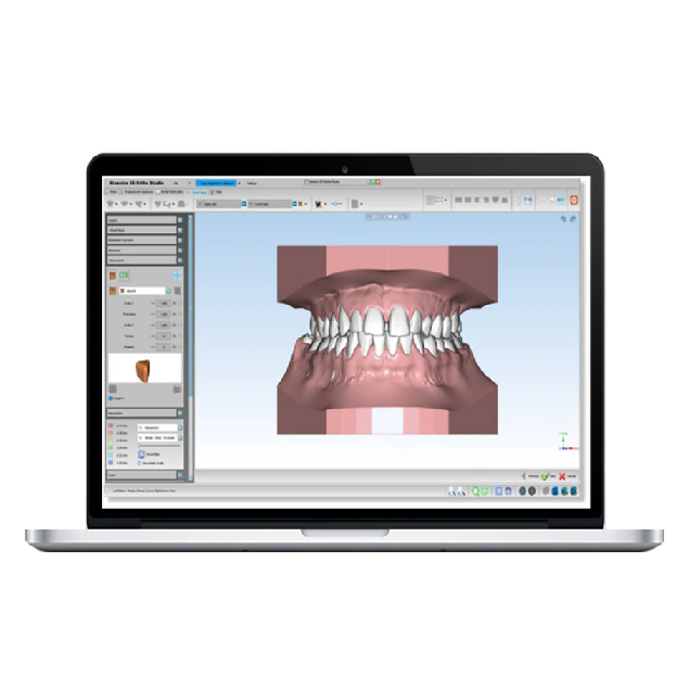 Logiciel d'orthodontie Maestro 3D - Configuration B