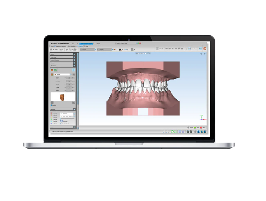 Logiciel d'orthodontie Maestro 3D - Configuration B
