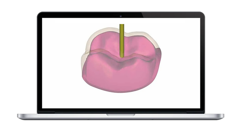 Module Coquille Provisoire