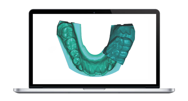 Module Jaw Motion Import